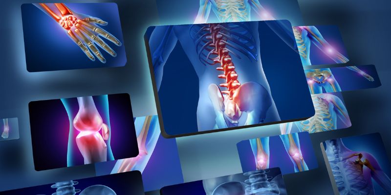 Defra: una nuova frontiera per la diagnosi dell'osteoporosi